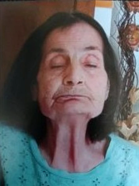 Nicolina Fresi Roglia Ved. Alias